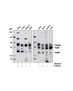 Cell Signaling Phospho-Foxo1 (Thr24)/Foxo3a (Thr32)/Foxo4 (Thr28) (4g6) Rabbit mAb