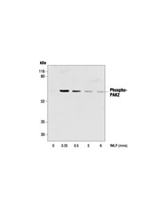 Cell Signaling Phospho-Pak1 (Thr423)/Pak2 (Thr402) Antibody