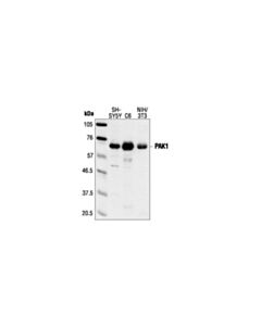 Cell Signaling Pak1 Antibody