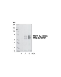 Cell Signaling Phospho-Pak1 (Ser199/204)/Pak2 (Ser192/197) Antibody