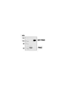 Cell Signaling Pak3 Antibody