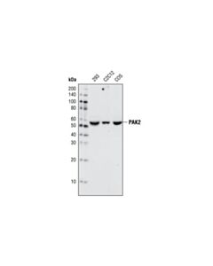 Cell Signaling Pak2 (C17a10) Rabbit mAb