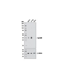Cell Signaling EpCAM (D1B3) Rabbit mAb 20 uL