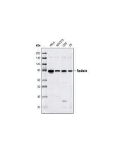 Cell Signaling Radixin (C4G7) Rabbit mAb 20 uL