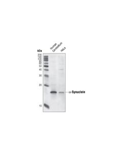 Cell Signaling Alpha-Synuclein (Syn204) Mouse mAb