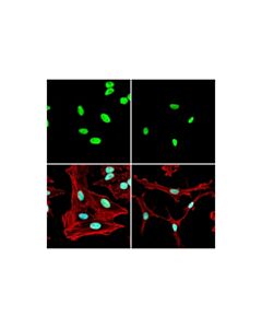 Cell Signaling Ubiquityl-Histone H2A (Lys119) (D27C4) Rabbit Monoclonal Antibody (Alexa Fluor ® 488 Conjugate)