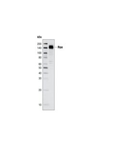 Cell Signaling Ron (C81H9) Rabbit mAb 20 uL