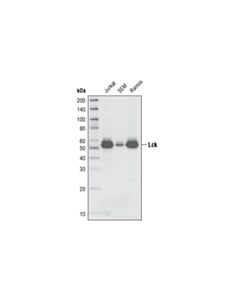 Cell Signaling Lck (L22B1) Mouse mAb 20 uL