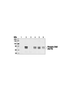 Cell Signaling Phospho-Chk2 (Ser19) Antibody