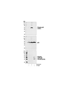Cell Signaling Phospho-P53 (Thr81) Antibody