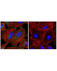 Cell Signaling beta-Catenin (L54E2) Mouse mAb 20 uL