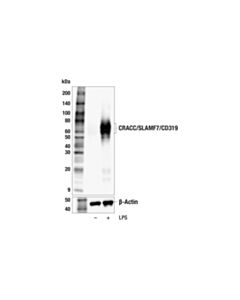 Cell Signaling CRACC/SLAMF7/CD319 (F6B9W) Rabbit mAb 20 µl