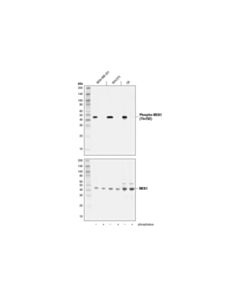 Cell Signaling Phospho-Mek1 (Thr292) (D5l3k) Rabbit mAb