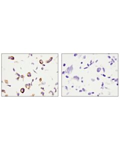 Cell Signaling Podoplanin (LpMab-12) Mouse mAb 20 uL