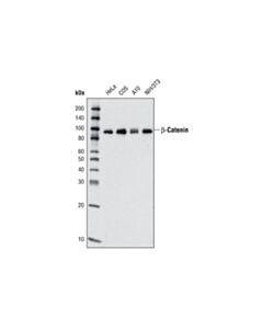 Cell Signaling beta-Catenin (L87A12) Mouse mAb 20 uL