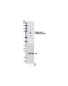 Cell Signaling Phospho-Zap-70 (Tyr493)/Syk (Tyr526) Antibody