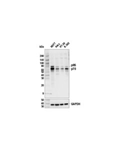 Cell Signaling P70 S6 Kinase (49d7) Rabbit mAb