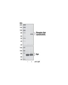 Cell Signaling Phospho-Syk (Tyr525/526) (C87c1) Rabbit mAb