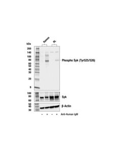 Cell Signaling Phospho-Syk (Tyr525/526) Antibody
