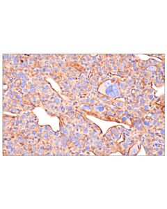 Cell Signaling PVR/CD155 (F2S3T) Rabbit Monoclonal Antibody
