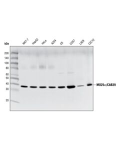 Cell Signaling MO25alpha/CAB39 (C49D8) Rabbit mAb 20 uL