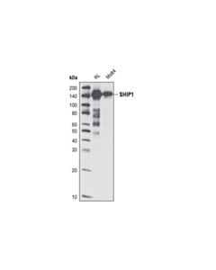 Cell Signaling SHIP1 (C15C9) Rabbit mAb 20 uL