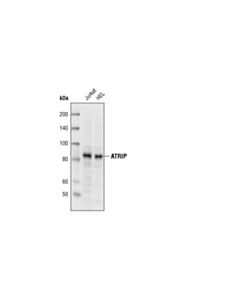 Cell Signaling Atrip Antibody
