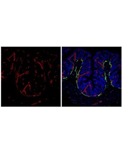 Cell Signaling CD31 (PECAM-1) (F2N3M) Rabbit mAb (Alexa Fluor ® 555 Conjugate)