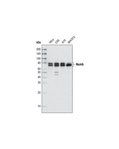 Cell Signaling Numb (C29g11) Rabbit mAb