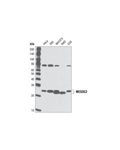 Cell Signaling MESDC2 (C22F5) Rabbit mAb 20 uL
