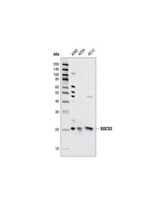 Cell Signaling Socs2 Antibody