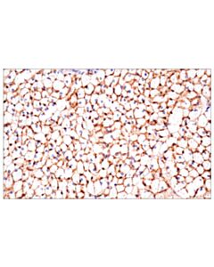 Cell Signaling Cd36 (E8b7s) Rabbit mAb