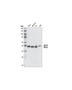 Cell Signaling Set7/Set9 Antibody