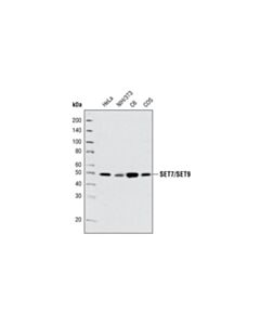 Cell Signaling SET7/SET9 (C24B1) Rabbit mAb 20 uL