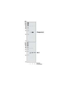 Cell Signaling Phospho-Bcl-2 (Ser70) (5h2) Rabbit mAb