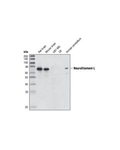 Cell Signaling Neurofilament-L (Da2) Mouse mAb