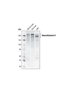 Cell Signaling Neurofilament-H (Rmdo 20) Mouse mAb