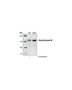 Cell Signaling Neurofilament-M (Rmo 14.9) Mouse mAb