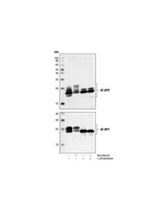 Cell Signaling 4e-Bp2 Antibody