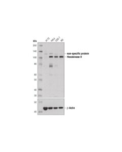 Cell Signaling Hexokinase Ii (C64g5) Rabbit mAb