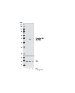 Cell Signaling Phospho-YB1 (Ser102) (C34A2) Rabbit mAb 20 uL