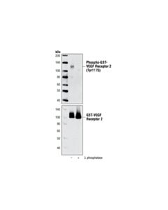 Cell Signaling Vegf Receptor 2 Control Proteins
