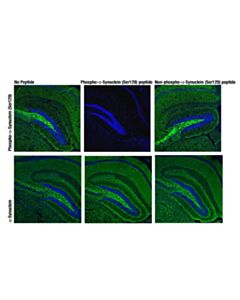 Cell Signaling Phosphoplus Alpha-Synuclein (Ser129) Antibody Duet