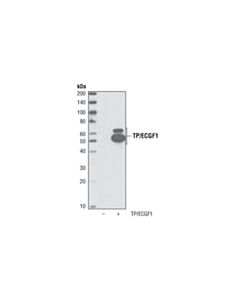 Cell Signaling Tp/Ecgf1 Antibody