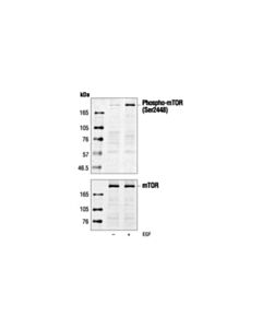 Cell Signaling Phospho-Mtor (Ser2448) Antibody