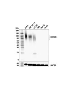 Cell Signaling CD200R (F2I2U) Rabbit mAb