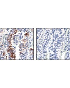 Cell Signaling Phospho-mTOR (Ser2448) (49F9) Rabbit mAb 20 uL