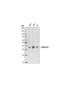 Cell Signaling Cyclin D1 (92g2) Rabbit mAb