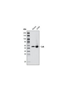 Cell Signaling Lck (D88) Xp Rabbit mAb