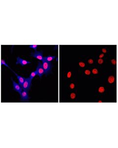 Cell Signaling Rabbit (Da1e) mAb Igg Xp Isotype Control (Alexa Fluor 647 Conjugate)